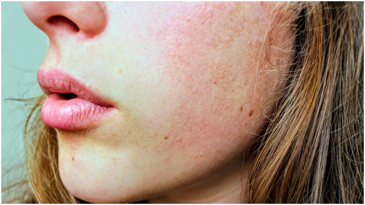 सर्दियों में विटामिन की कमी बना सकती है त्वचा को रूखा और बेजान — जानें कैसे रखें अपनी स्किन का ख्याल