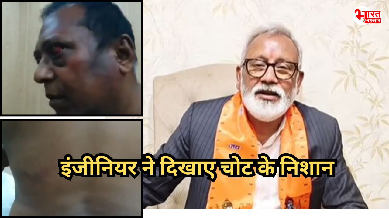 श्रीगंगानगर: AEN ने दिखाए अपनी चोटों के निशान, विधायक बिहाणी और उनके लोगों पर लगाए पीटने के आरोप