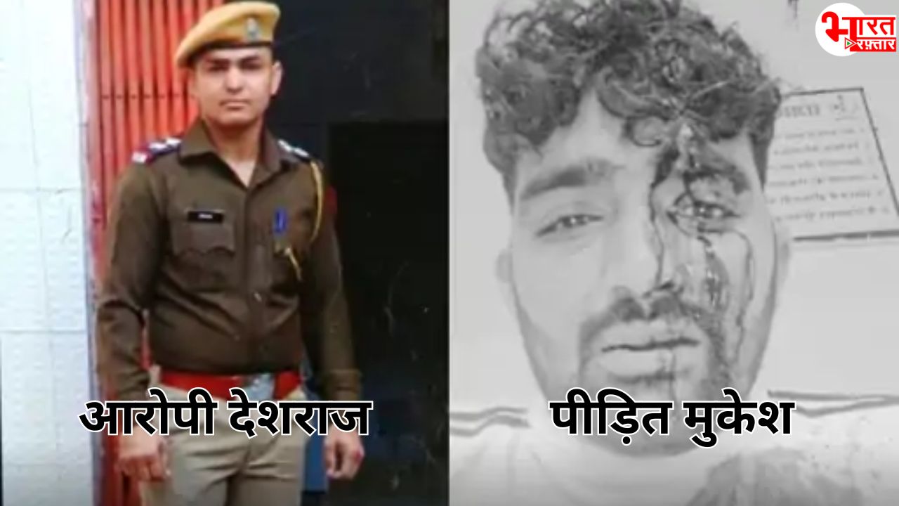 गर्म दूध नहीं लाने पर SI का कहर! पहलवान का डम्बल से फोड़ा सिर, FIR दर्ज