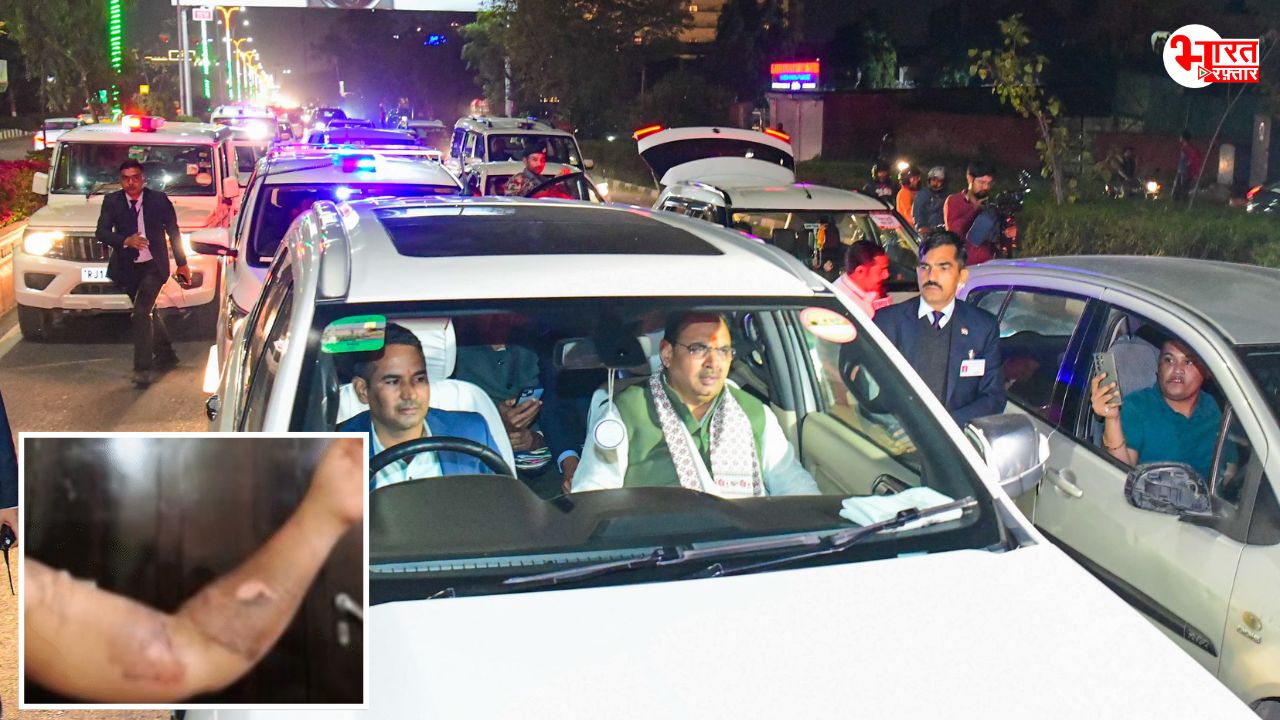 खौलता पानी ही शरीर पर फेंक दिया! CM भजनलाल के काफिले में जलाई गई युवती ने पुलिस पर केस किया दर्ज